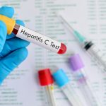 درمان هپاتیت سی در کشور رایگان شد
