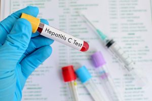 درمان هپاتیت سی در کشور رایگان شد